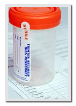 Urine sample bottle
